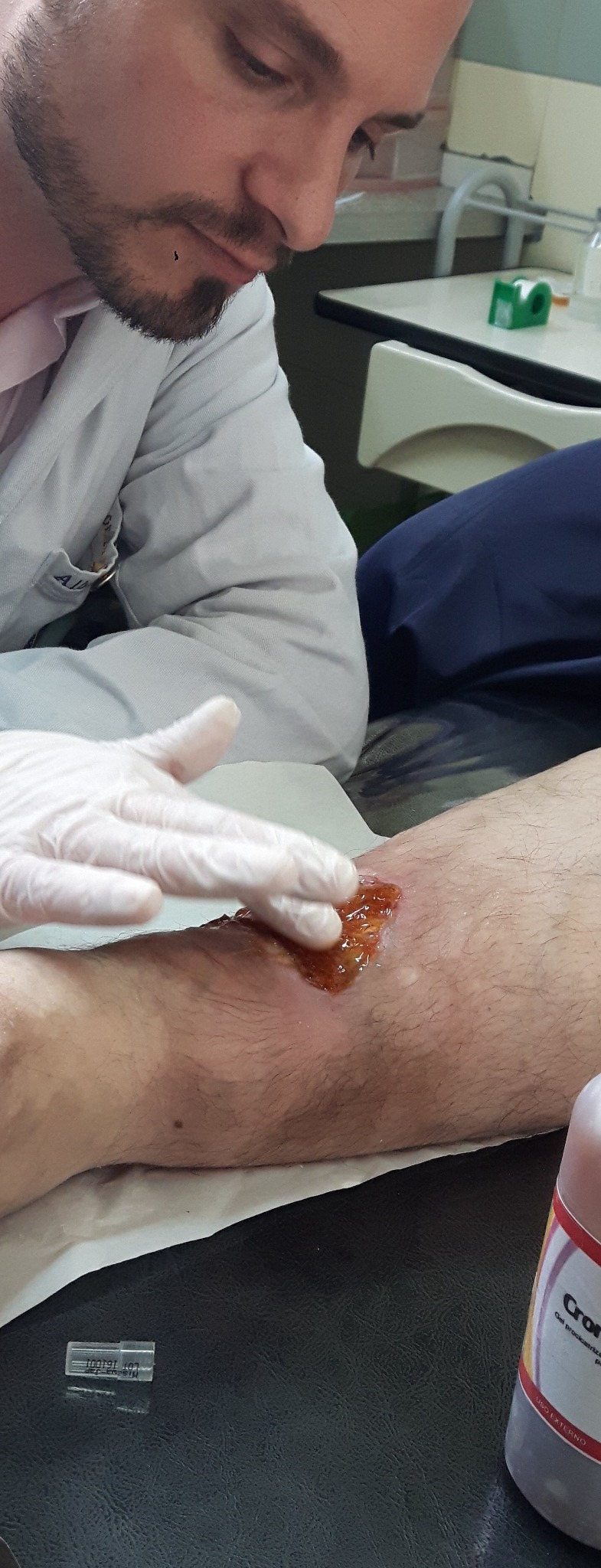 Alberto trabajando con una formulación para heridas